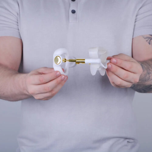 penile traction therapy device for curvature and length recovery