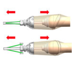 weighted foreskin restoration retainer side view traction device